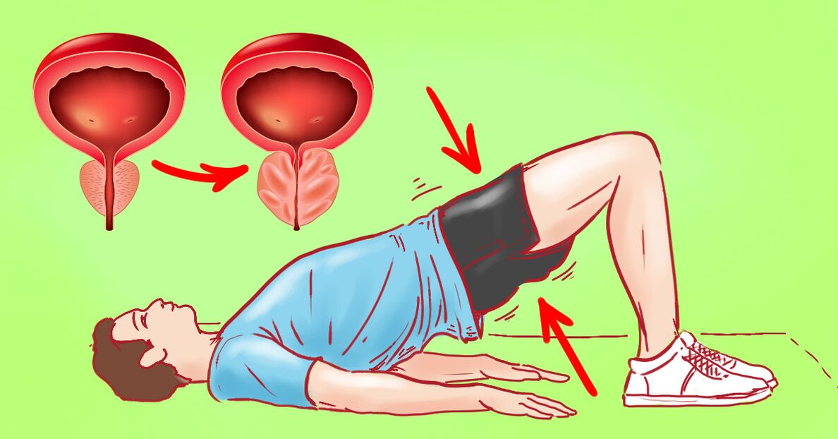 Exercices thérapeutiques pour la prostatite chronique. 